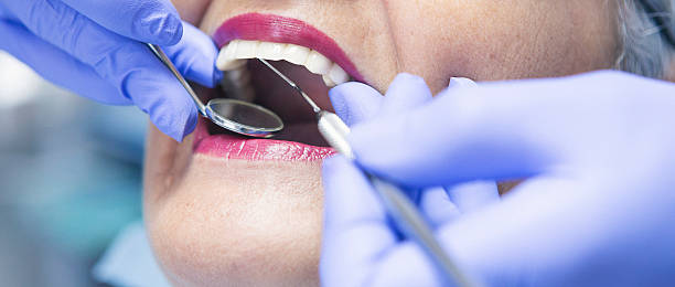 Best Emergency Tooth Extraction in Beverly Hills, TX
